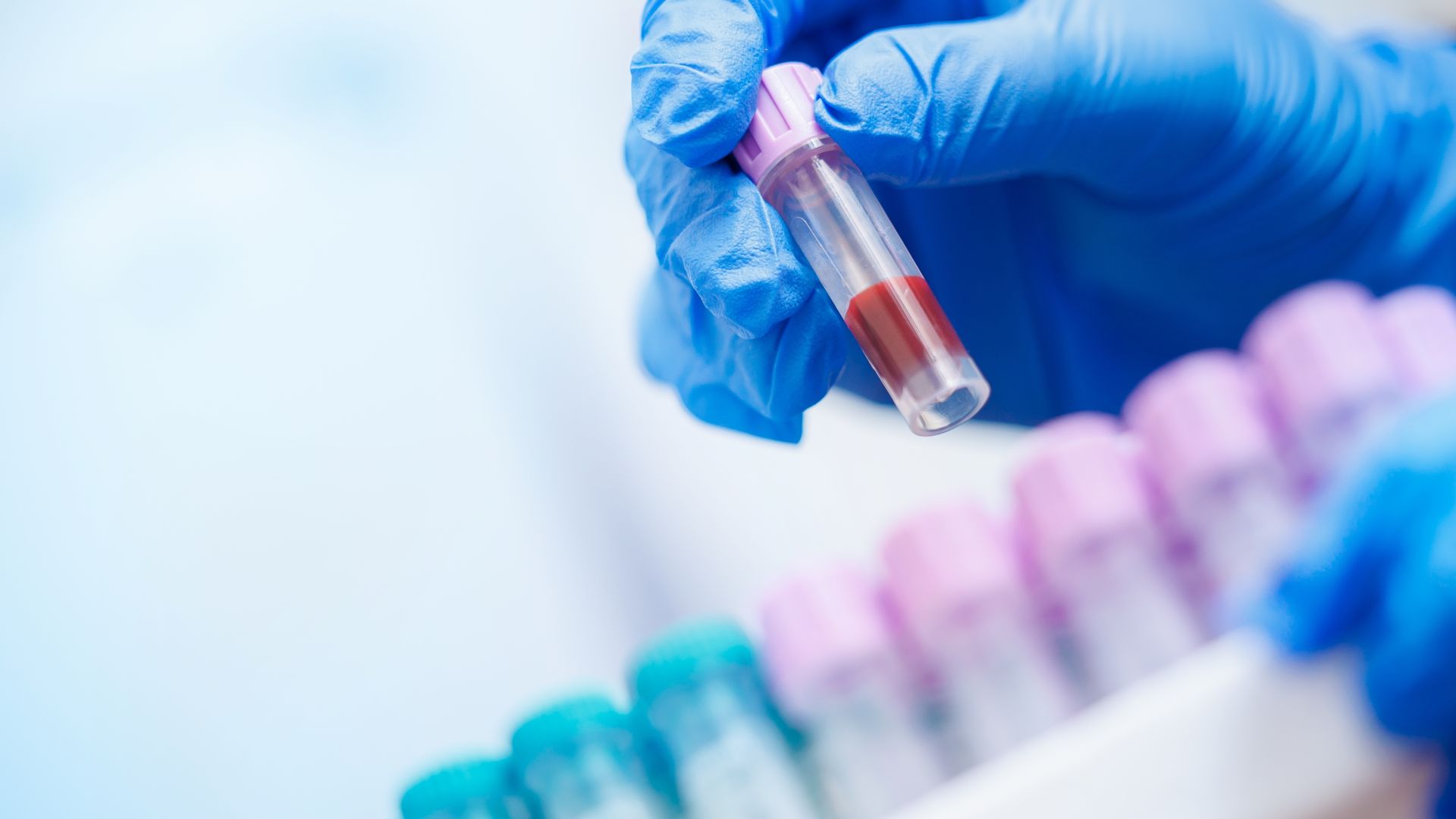 CO₂-ul din atmosferă începe să se vadă în sângele oamenilor. Studiu: schimbări reale în analizele medicale